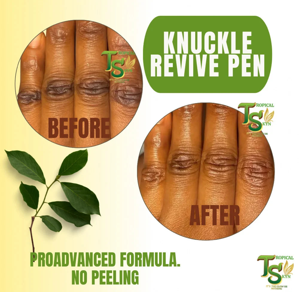 Knuckle Revive Pen