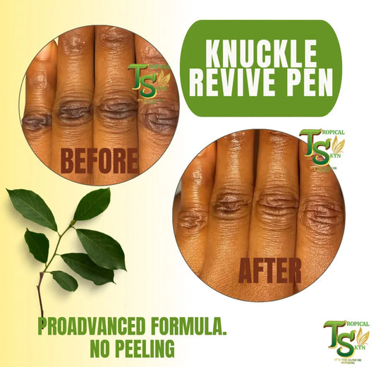 Knuckle Revive Pen