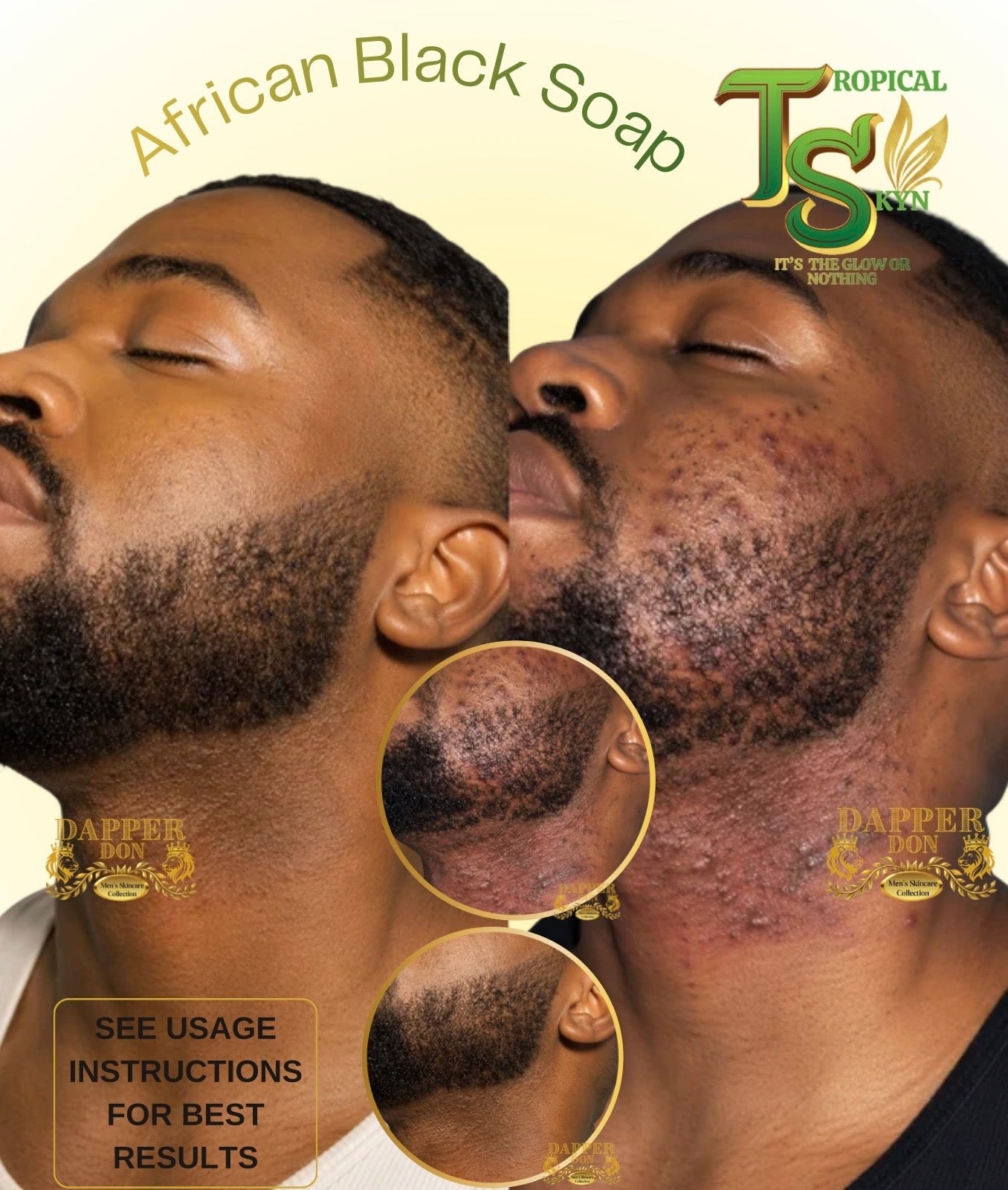 Photo of before and after razor bump treatment 