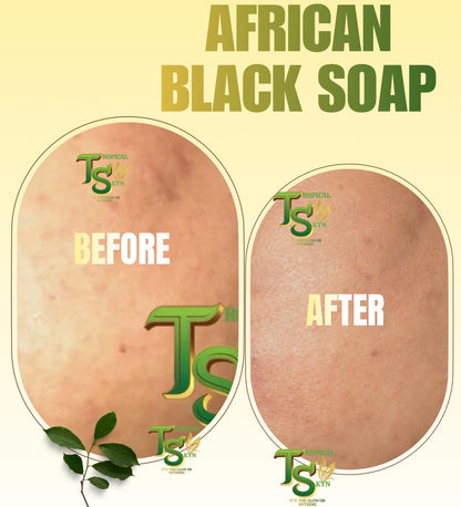African Black Soap Before and after results