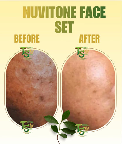 Before and after comparison of Nuvitone Face Set from Tropical Skyn
