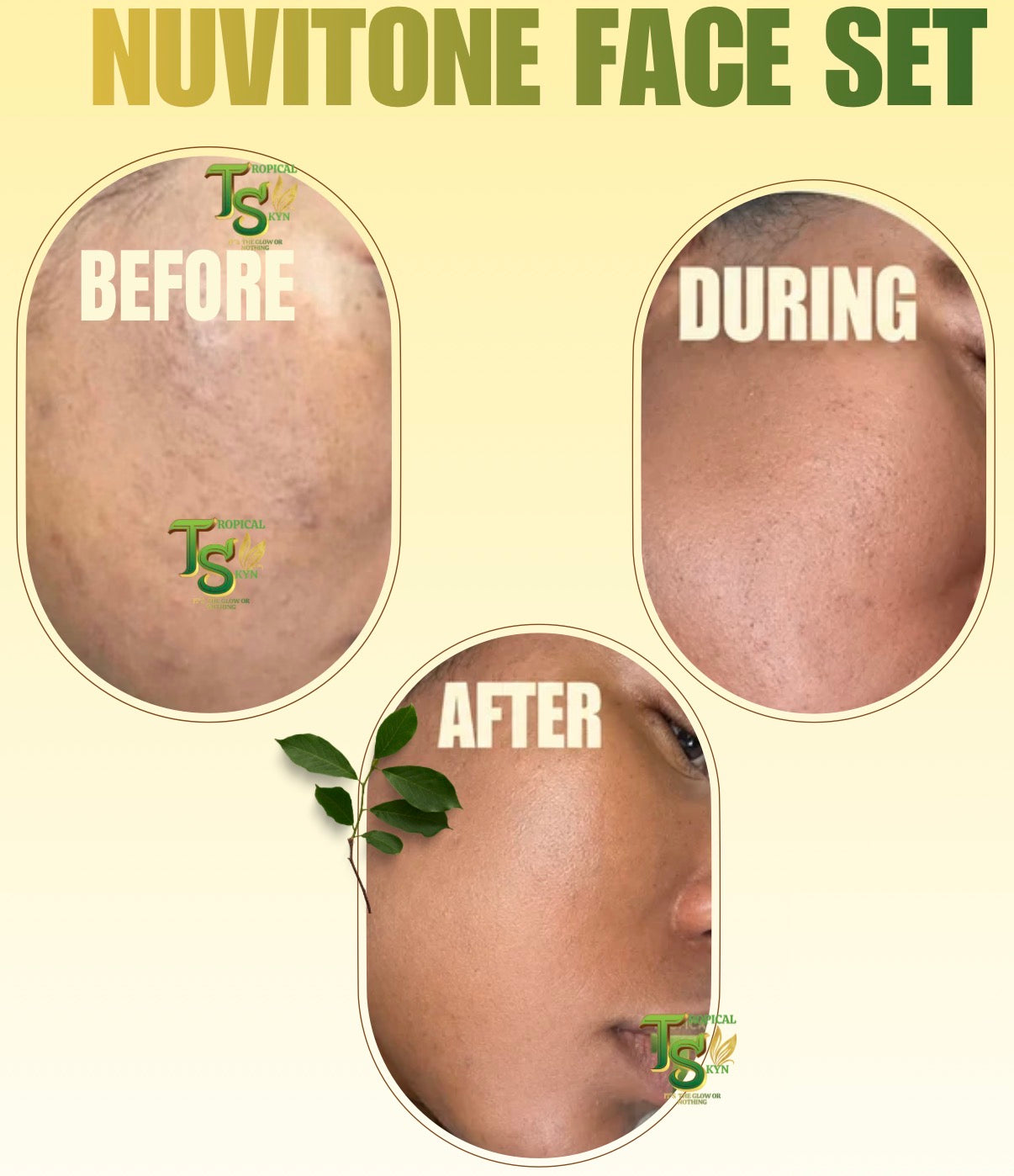 Before and after skincare results 