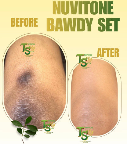 Before and after comparison of Nuvitone Bawdy Set on a beige background with Tropical Skyn logo.