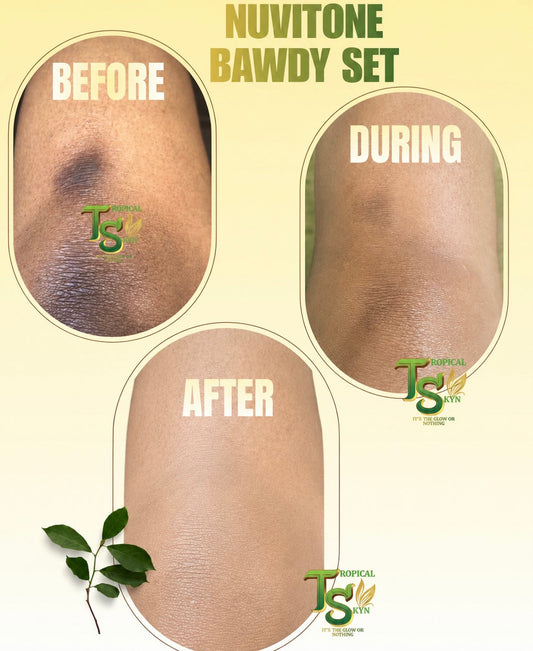 Skin brightening body lotion, Nuvitone