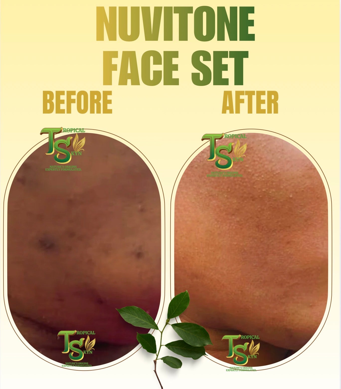 Before and after comparison of Nuvitone Face Set